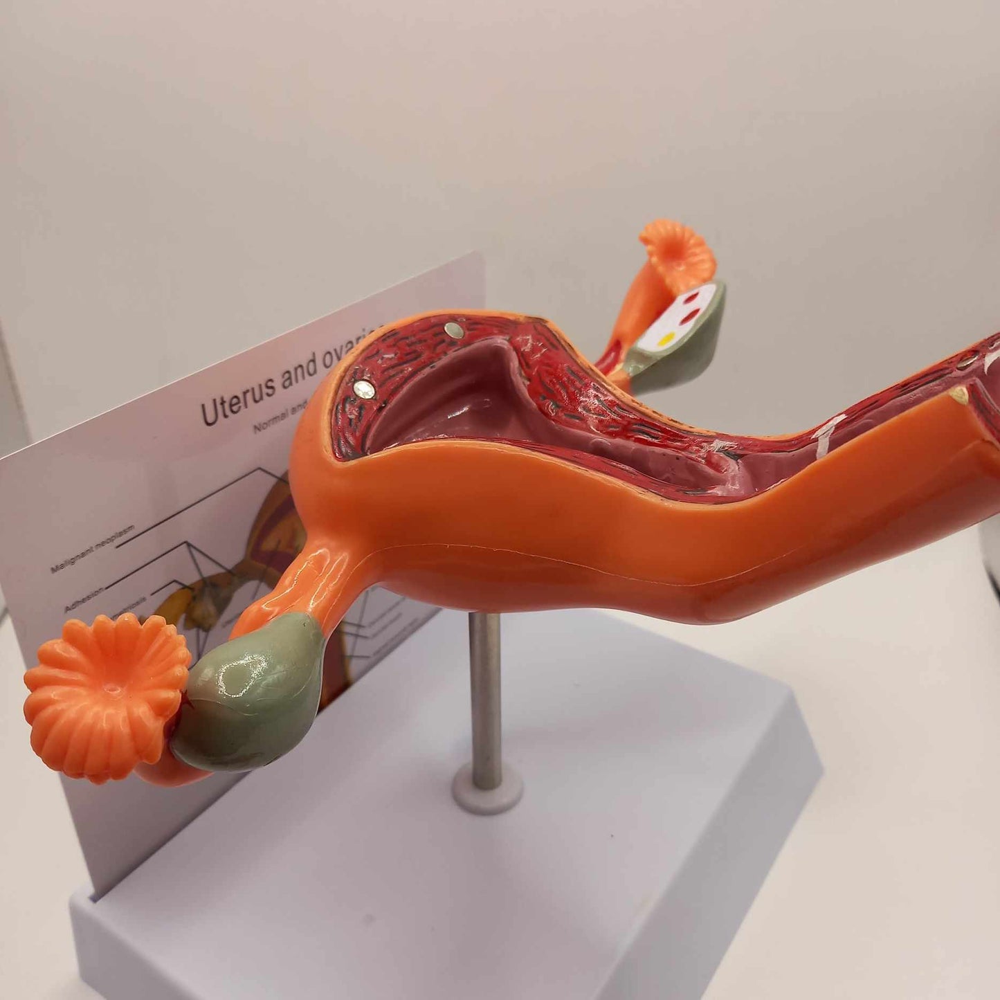 Lady Parts