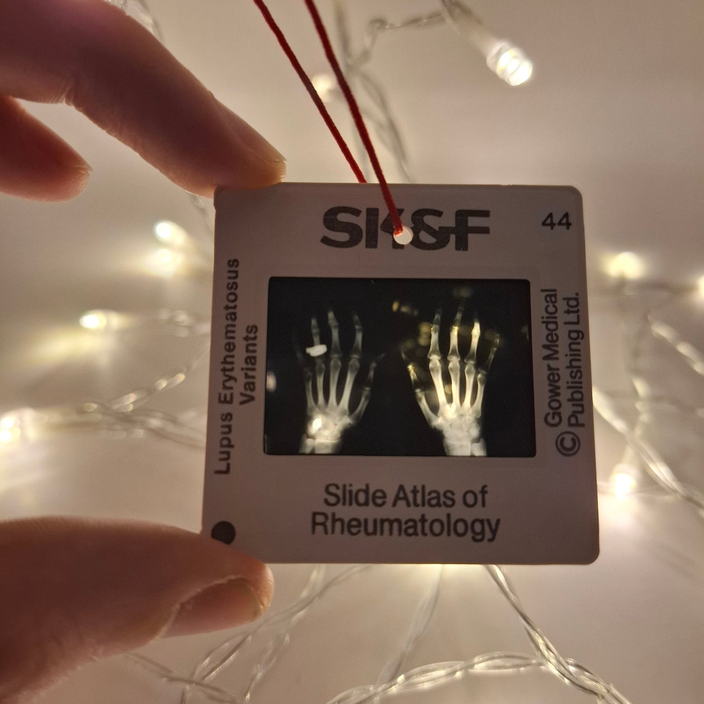 Medical Slide
