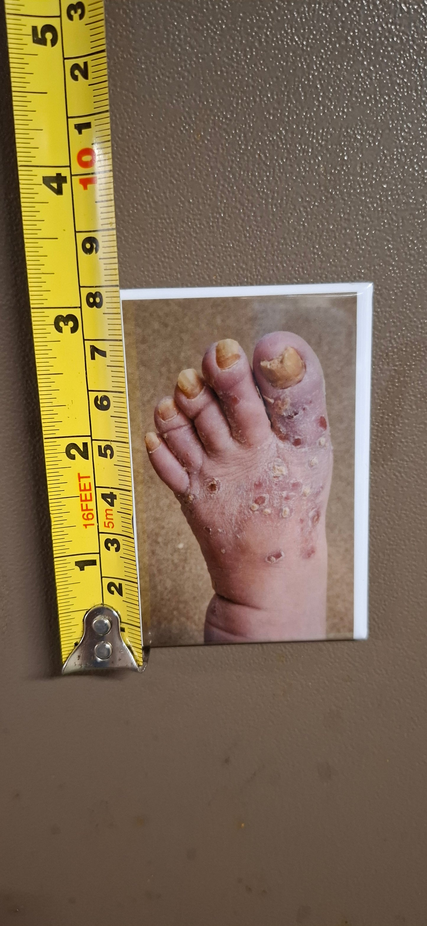 My Dad's Toes 2025 Update - Fridge Magnet