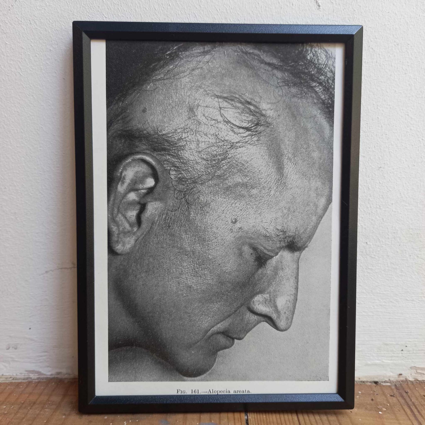 Framed Pages from an antique book on Skin Diseases