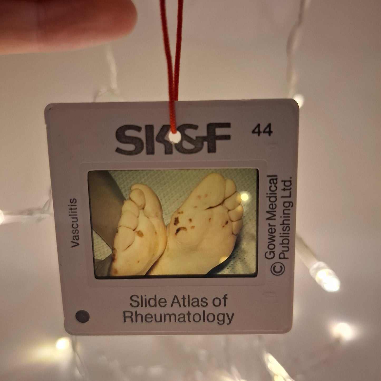 Medical Slide