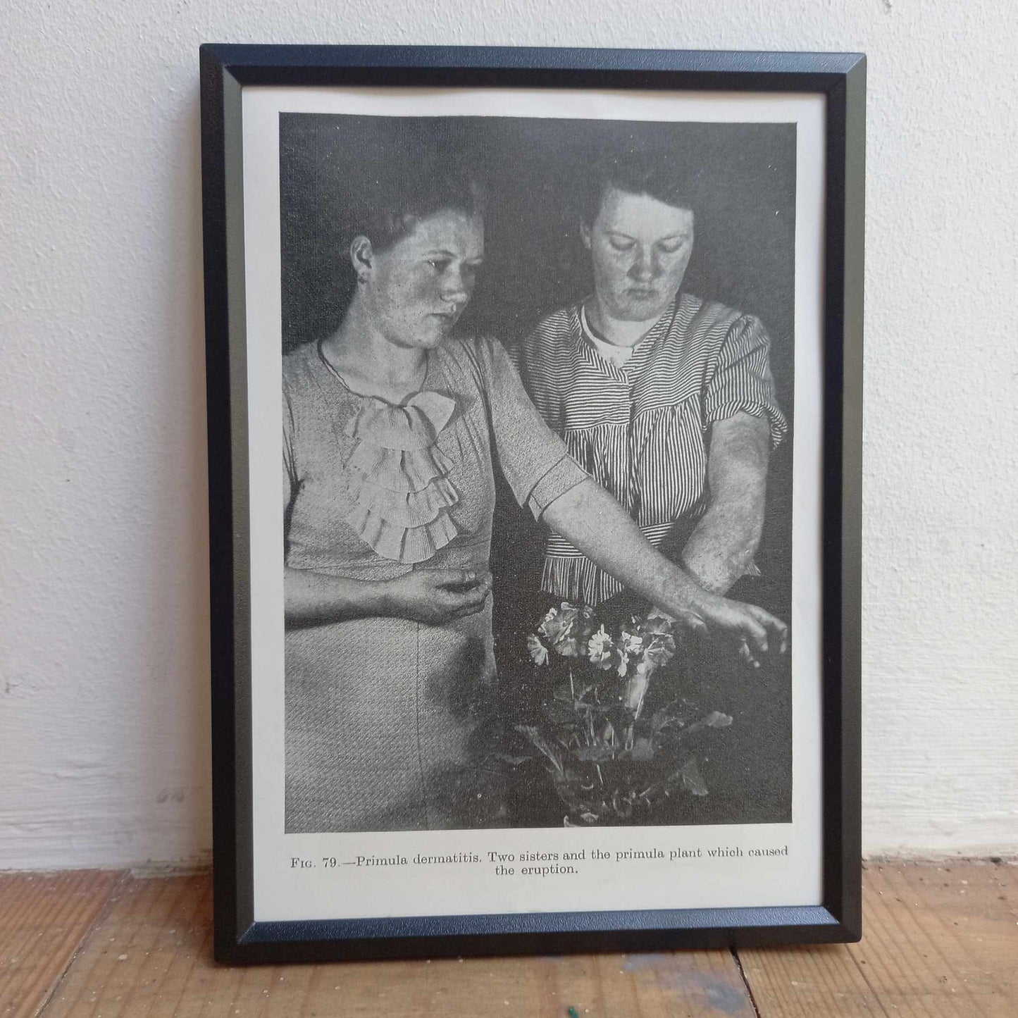 Framed Pages from an antique book on Skin Diseases