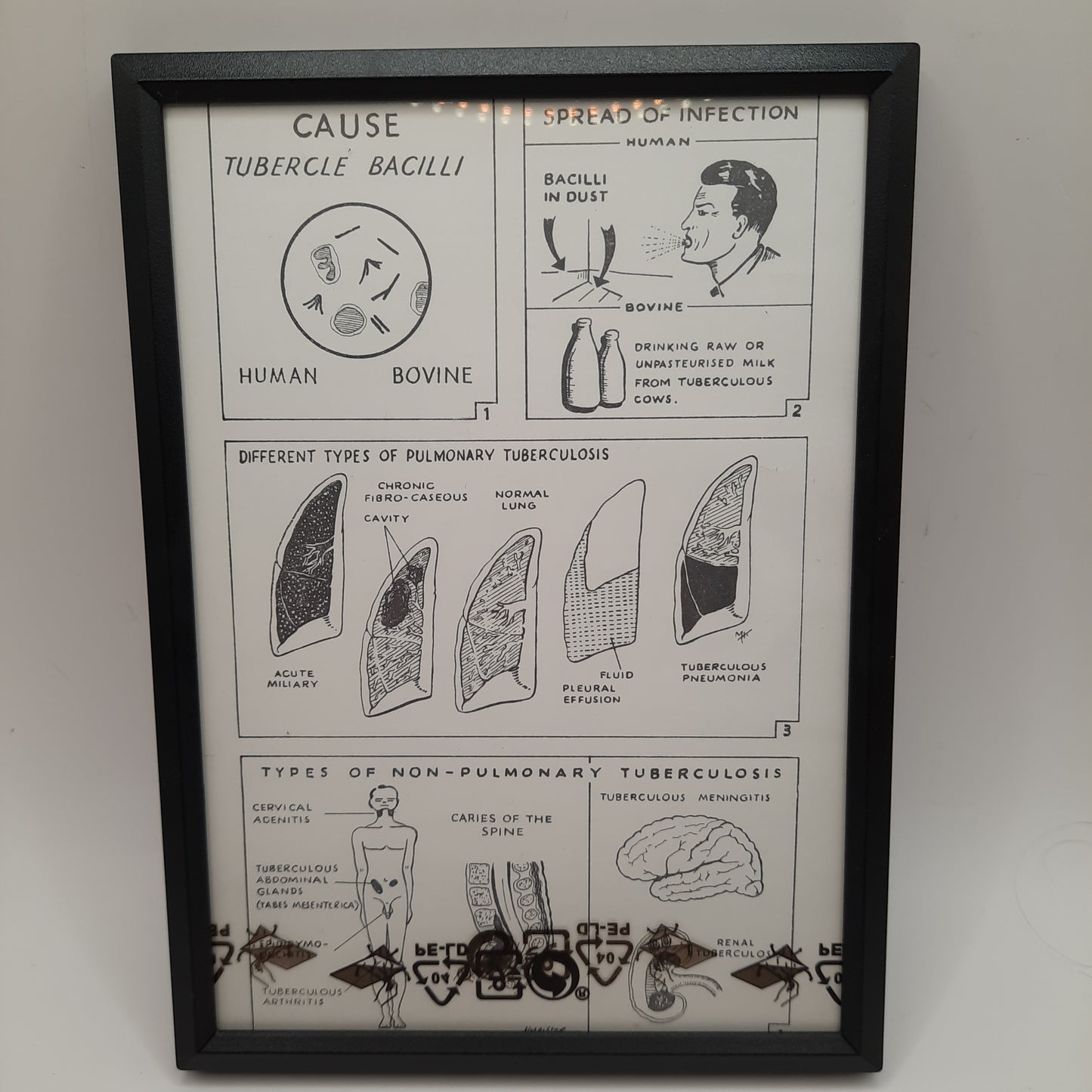 Framed Nursing Diagrams