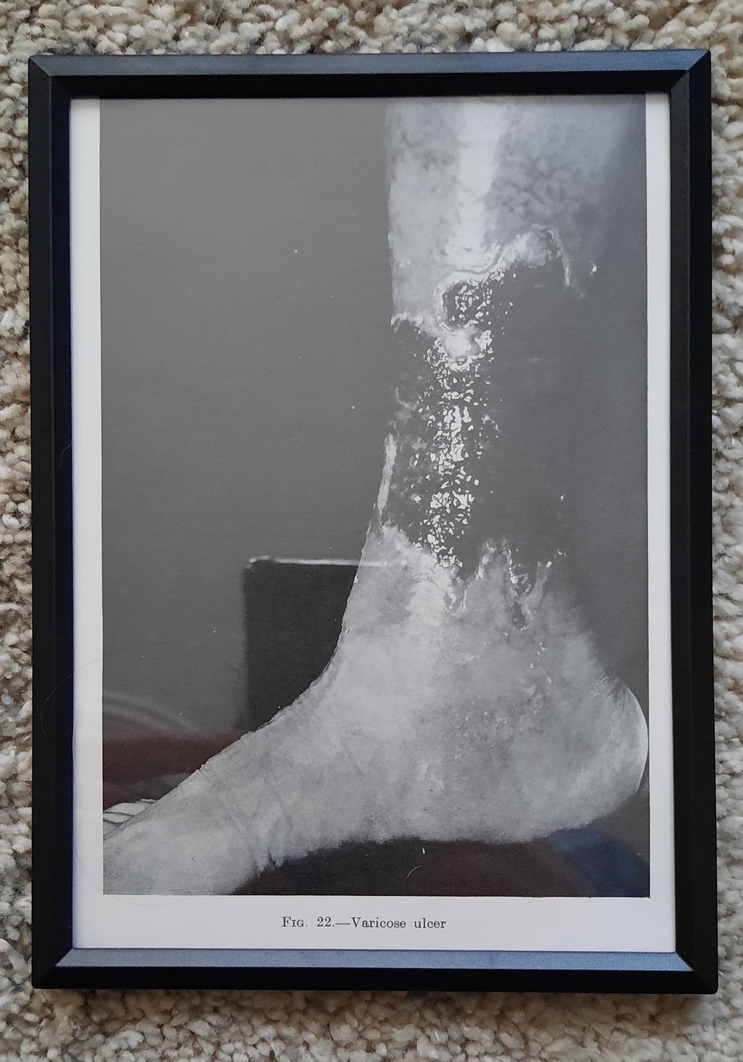 Framed Pages from an antique book on Skin Diseases