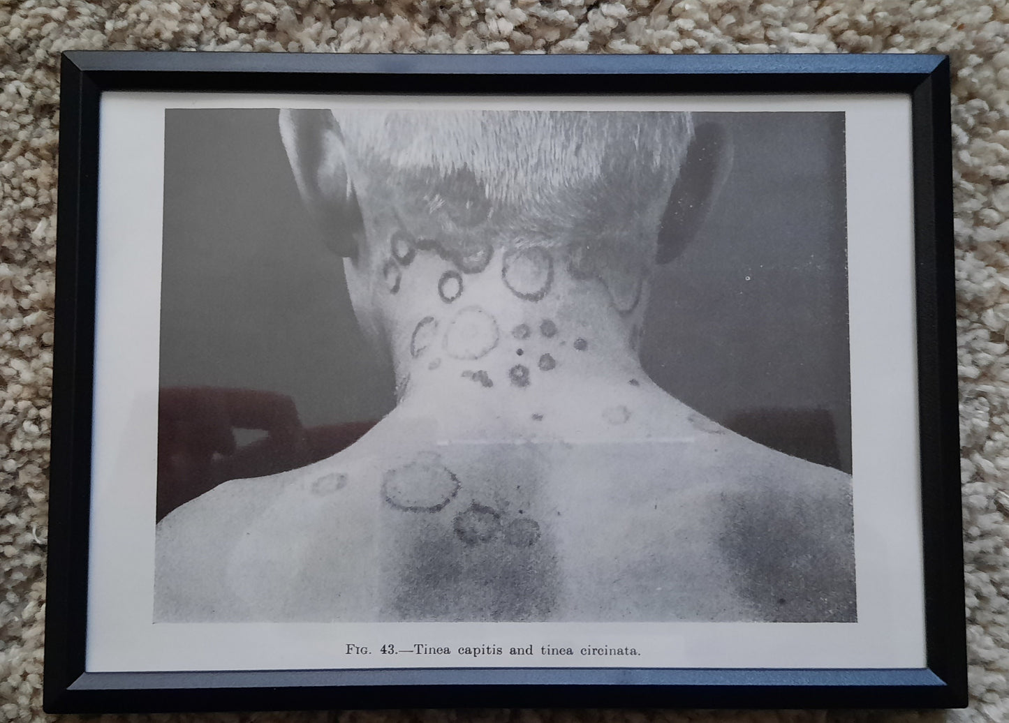 Framed Pages from an antique book on Skin Diseases