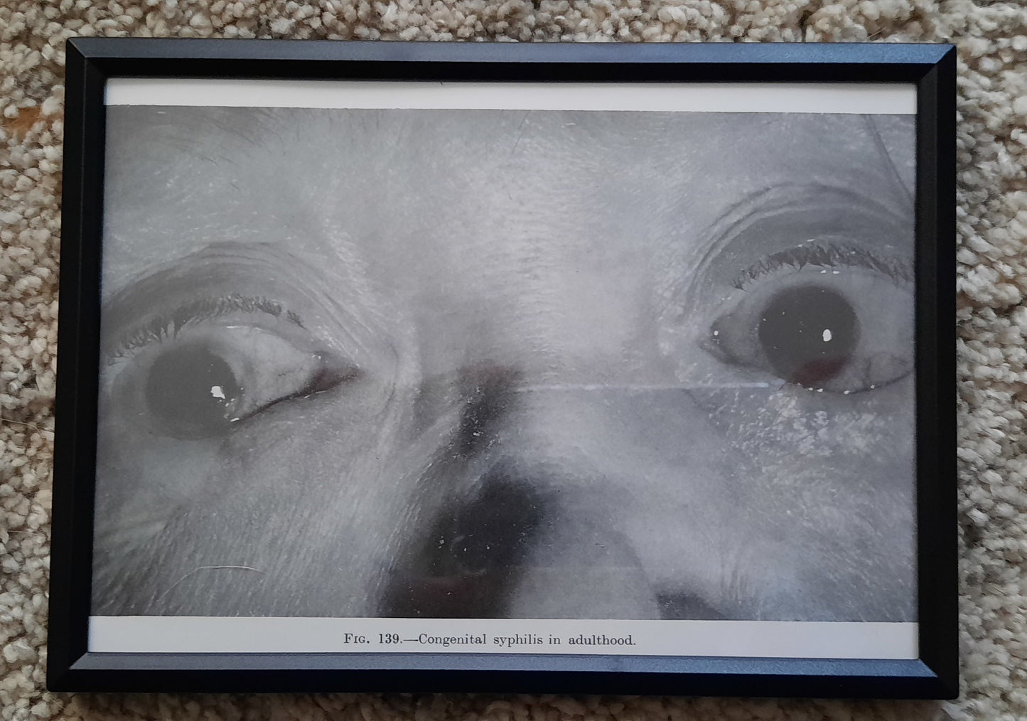 Framed Pages from an antique book on Skin Diseases