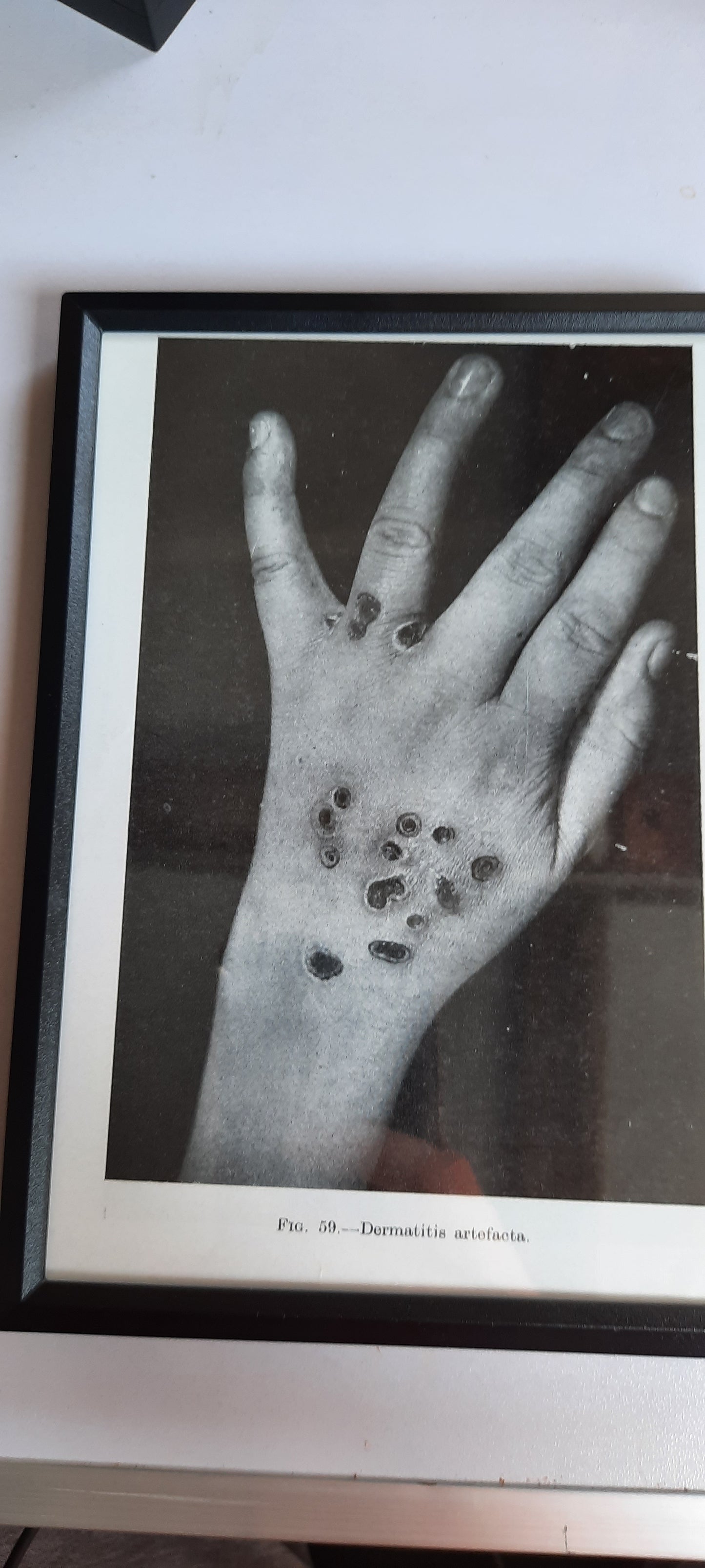 Framed Pages from an antique book on Skin Diseases