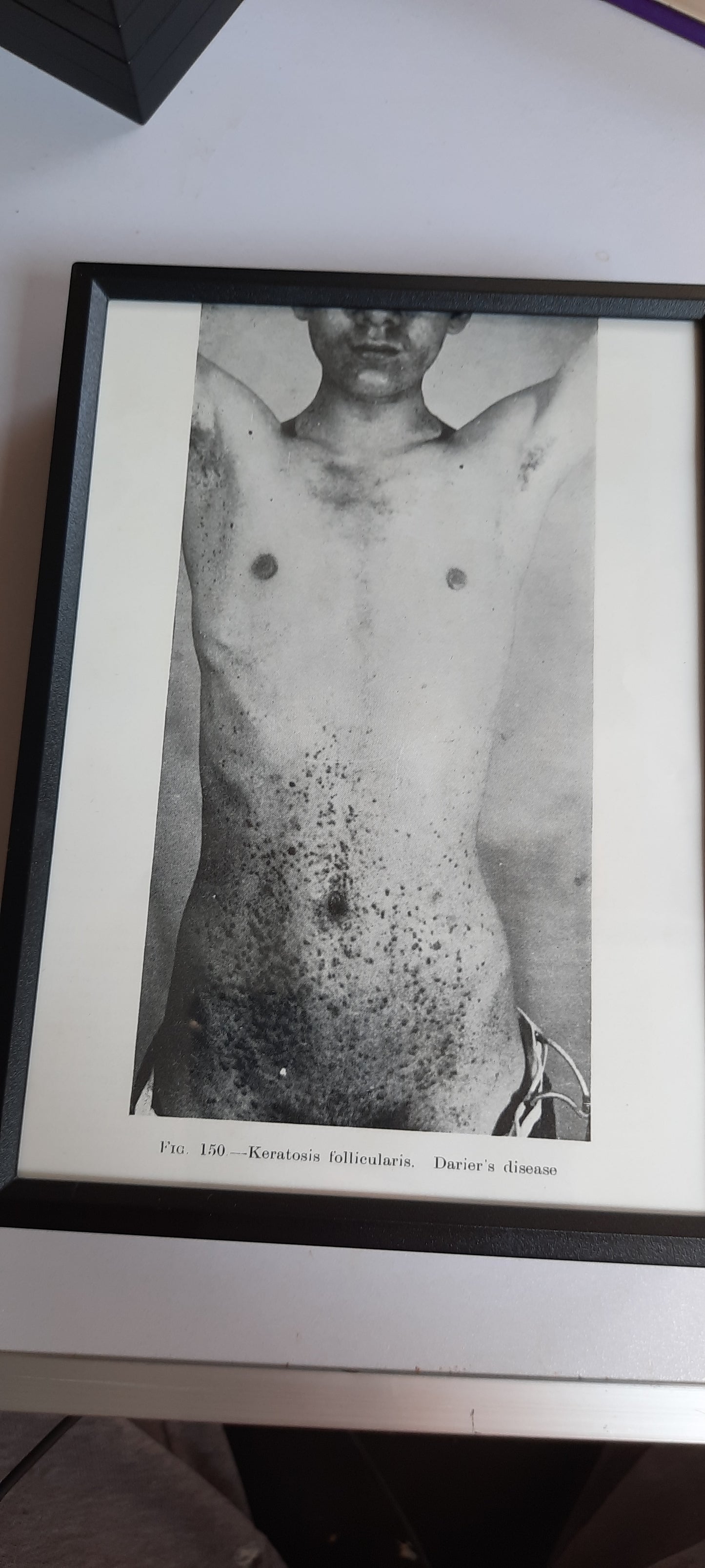 Framed Pages from an antique book on Skin Diseases
