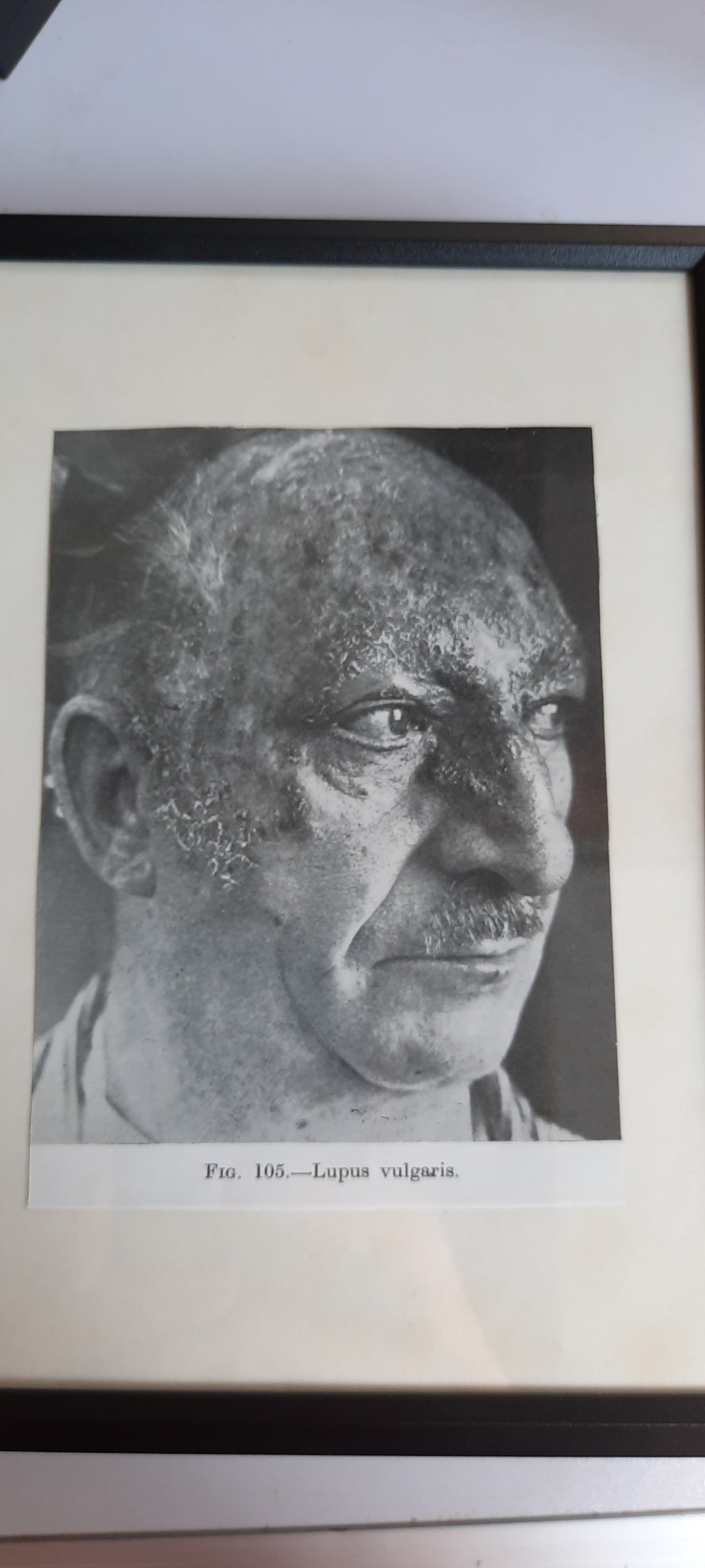 Framed Pages from an antique book on Skin Diseases