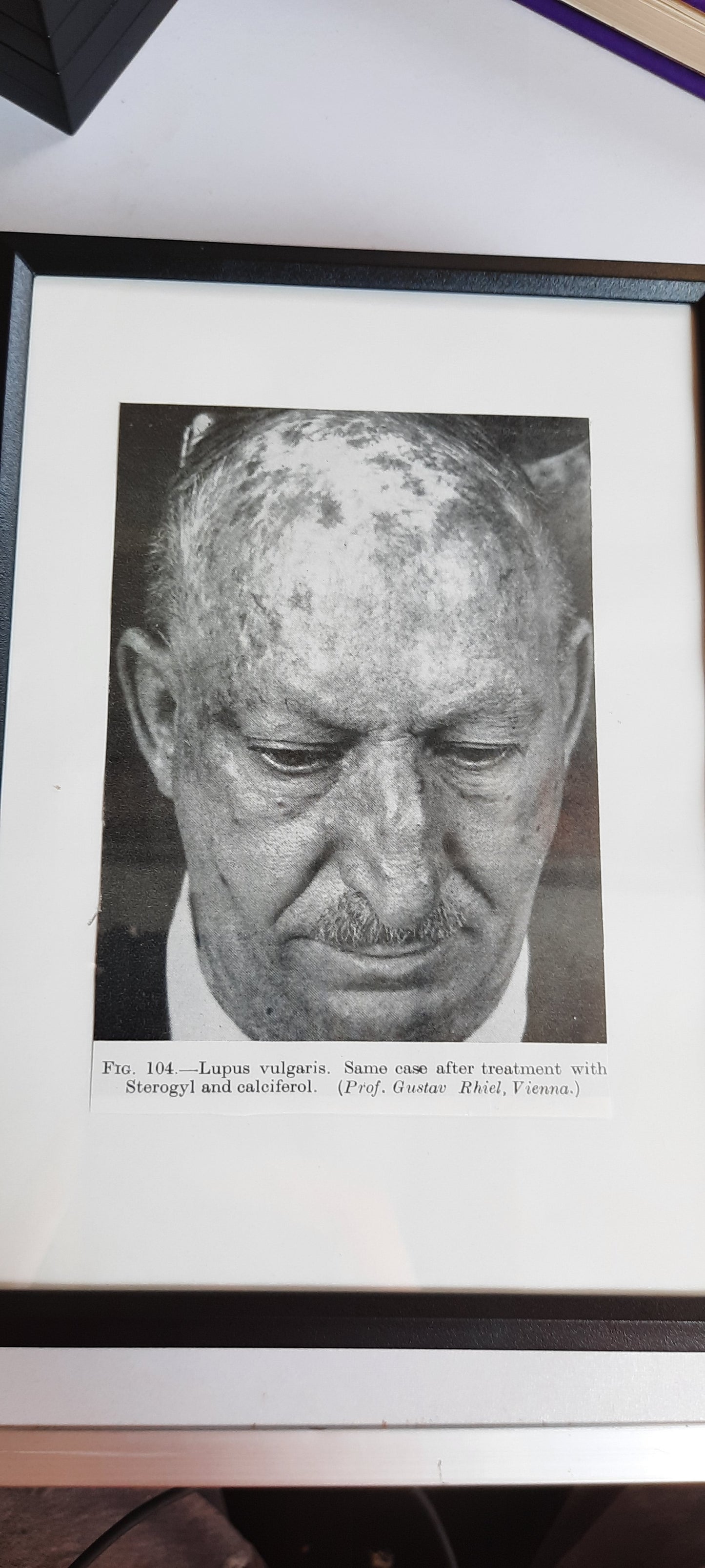 Framed Pages from an antique book on Skin Diseases