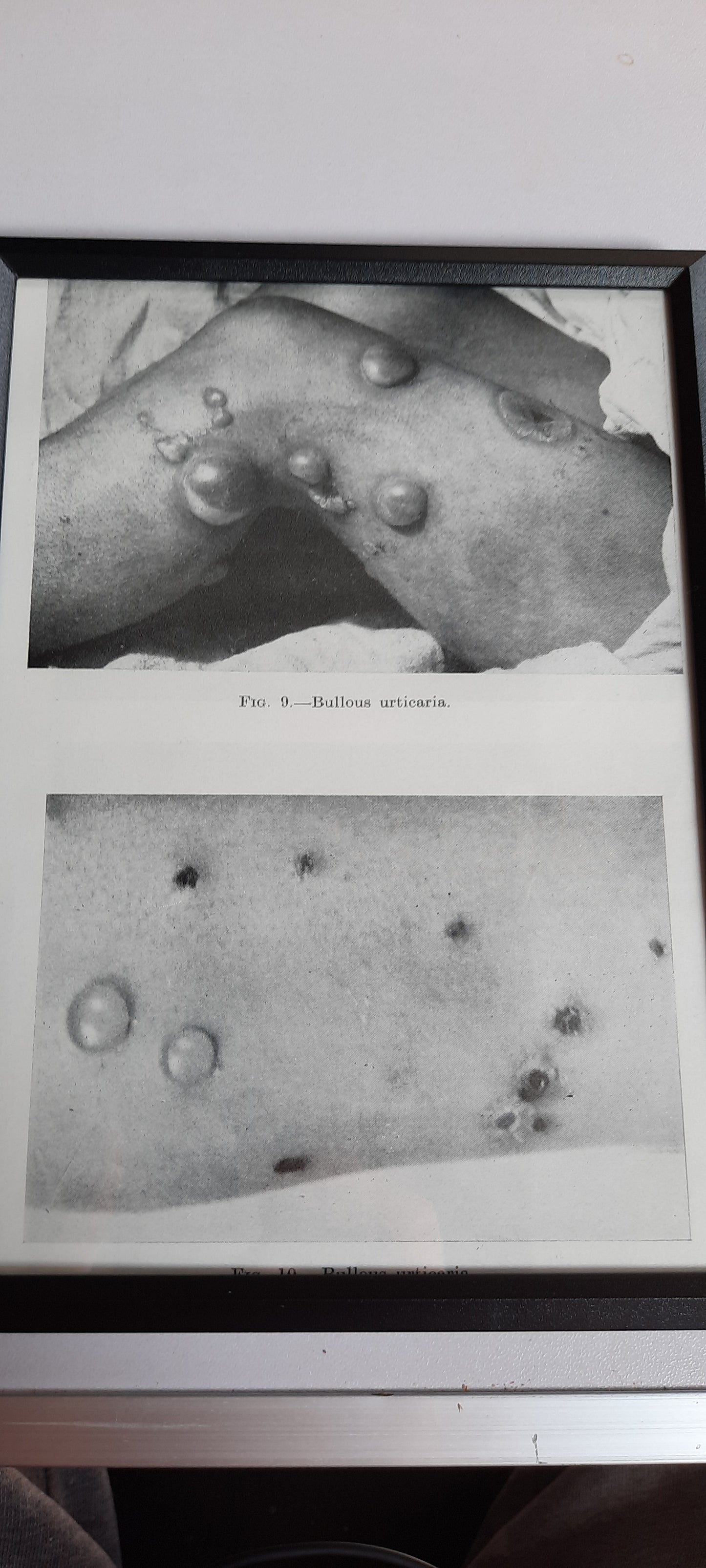 Framed Pages from an antique book on Skin Diseases