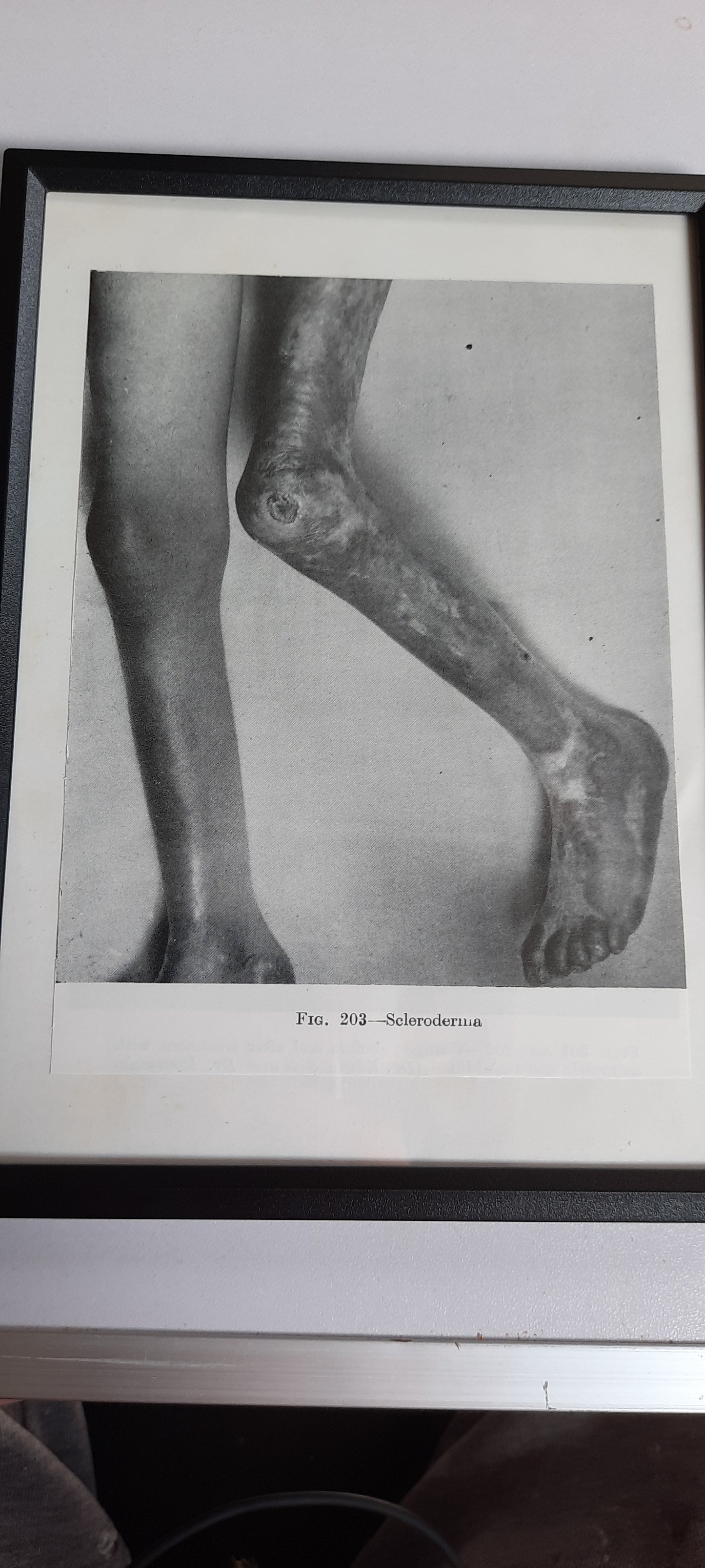 Framed Pages from an antique book on Skin Diseases