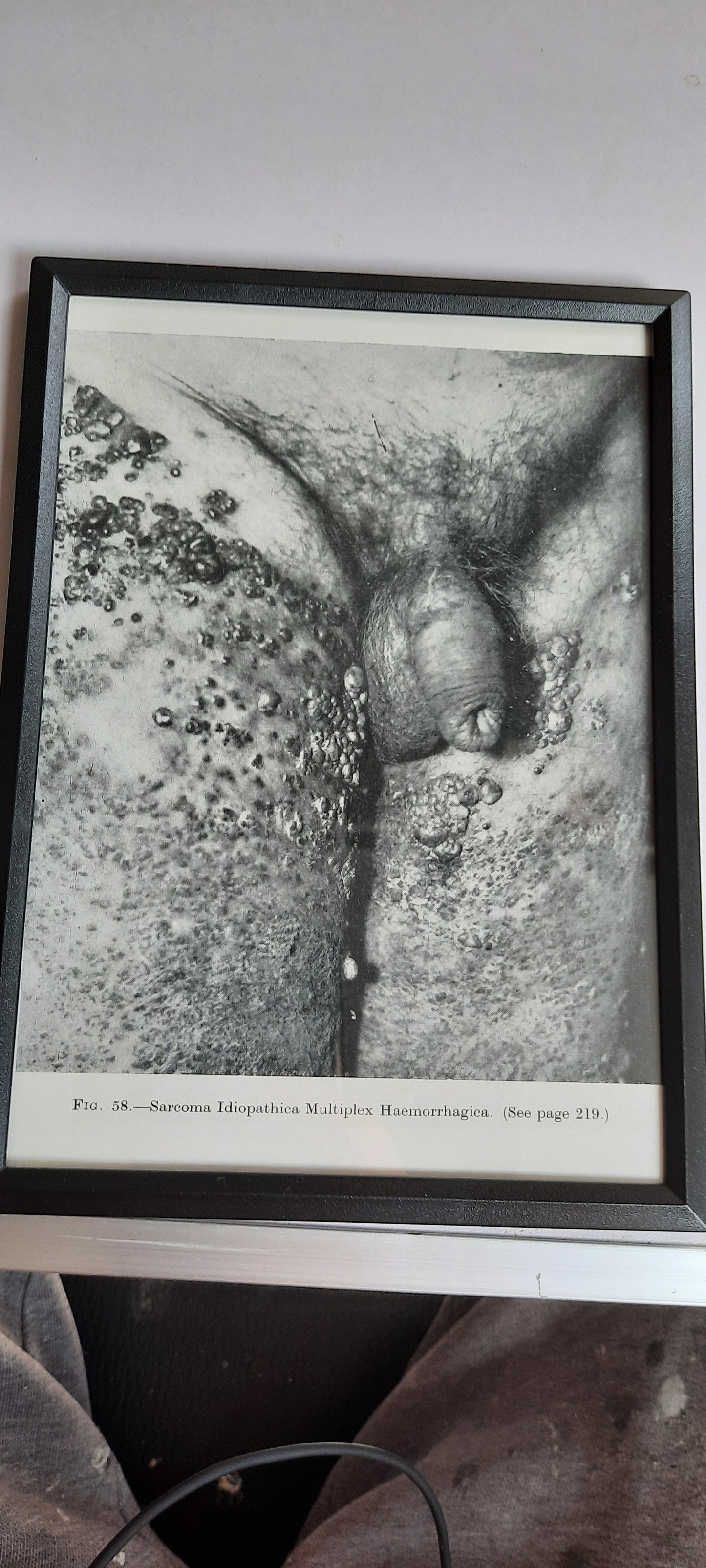 Framed Pages from an antique book on Skin Diseases
