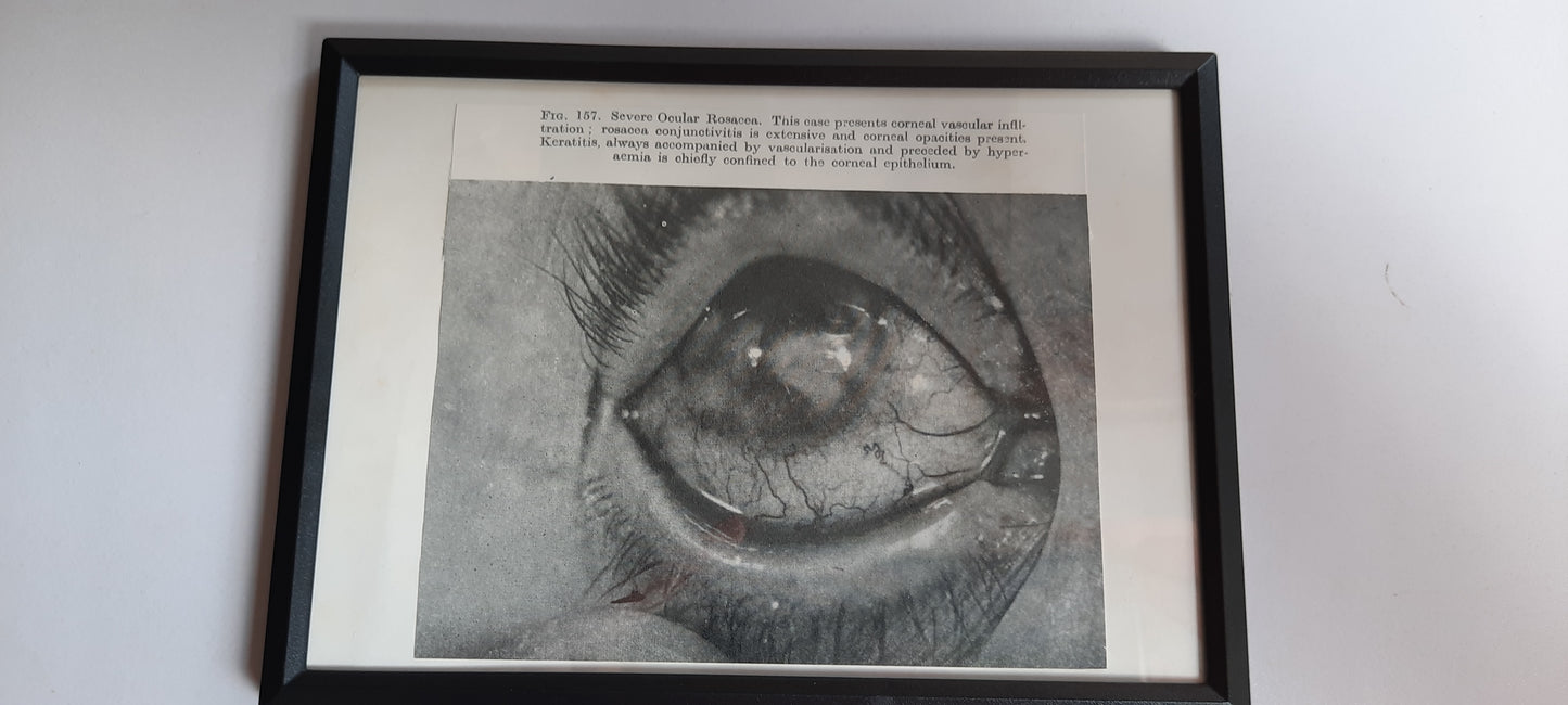 Framed Pages from an antique book on Skin Diseases