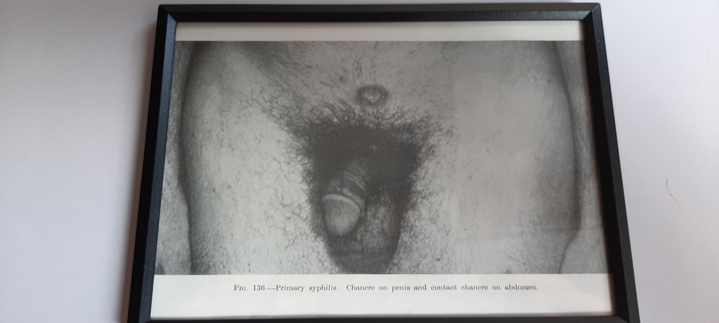 Framed Pages from an antique book on Skin Diseases