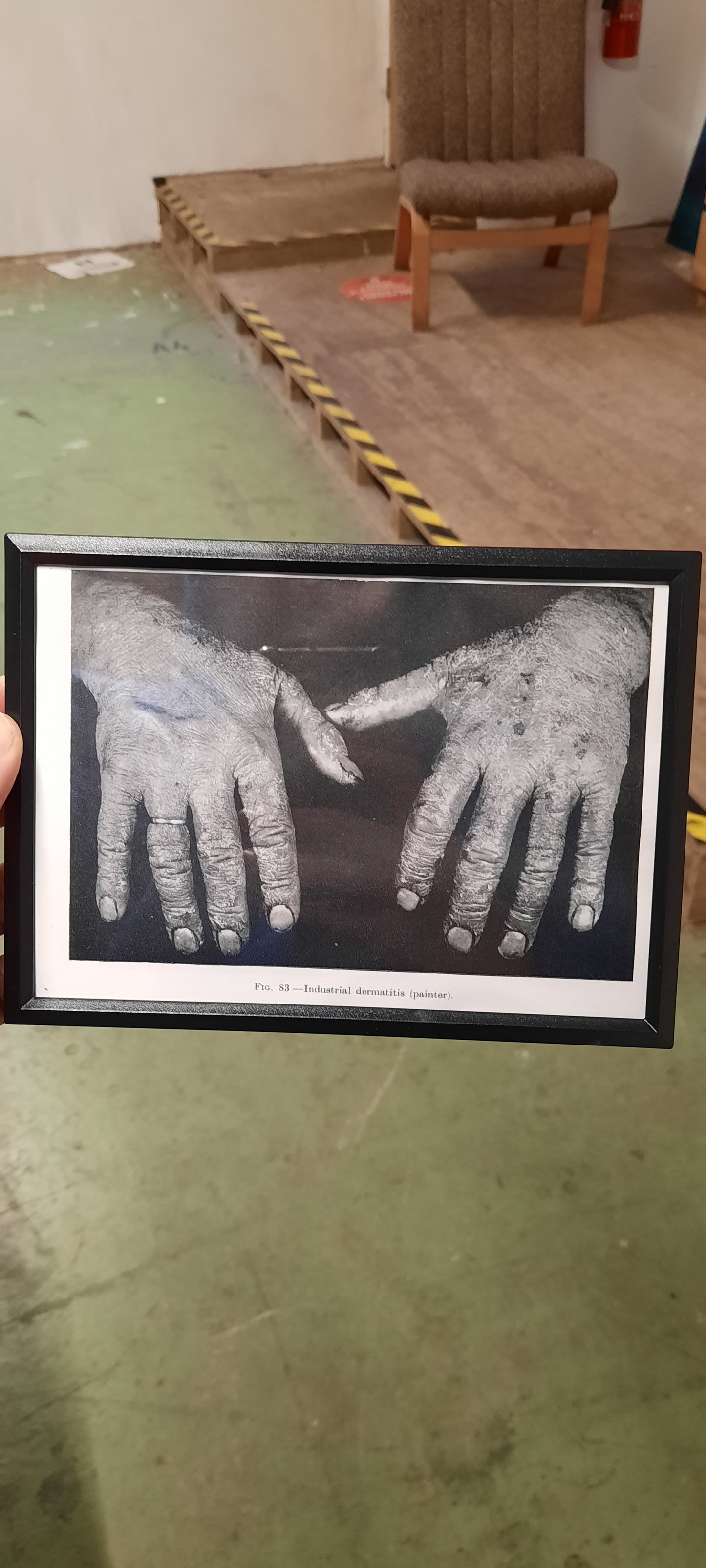 Framed Pages from an antique book on Skin Diseases
