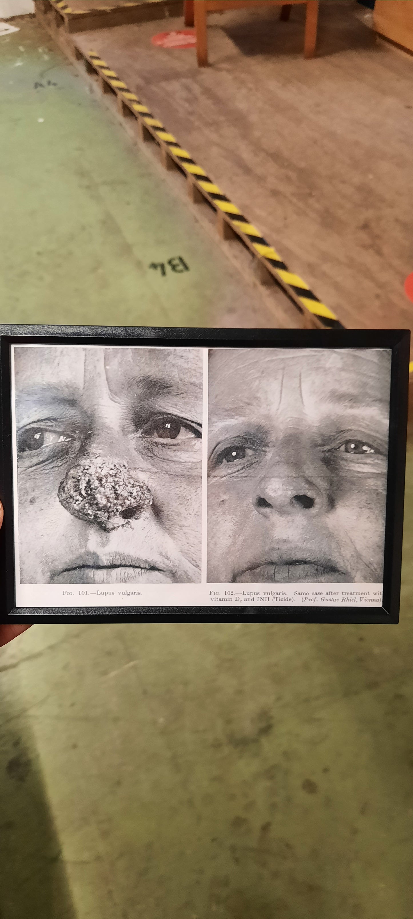 Framed Pages from an antique book on Skin Diseases