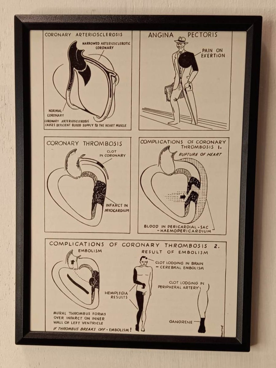 Framed Nursing Diagrams