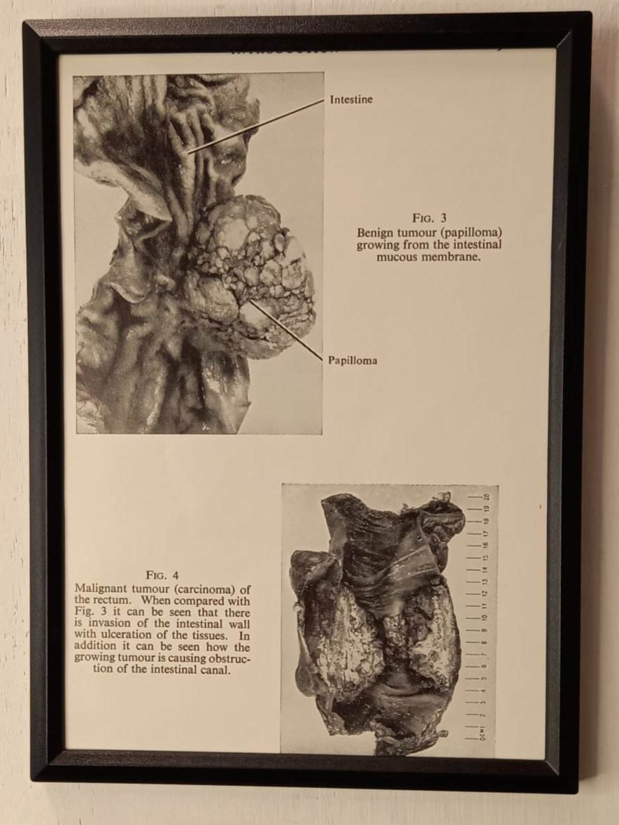 Framed Nursing Diagrams