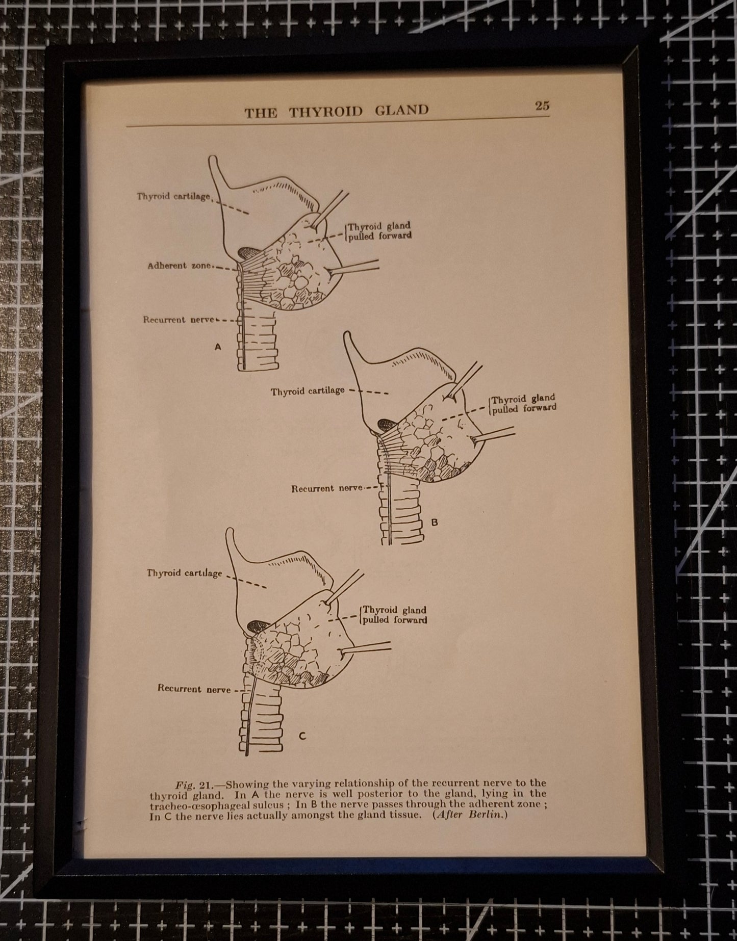 Framed Antique Pages