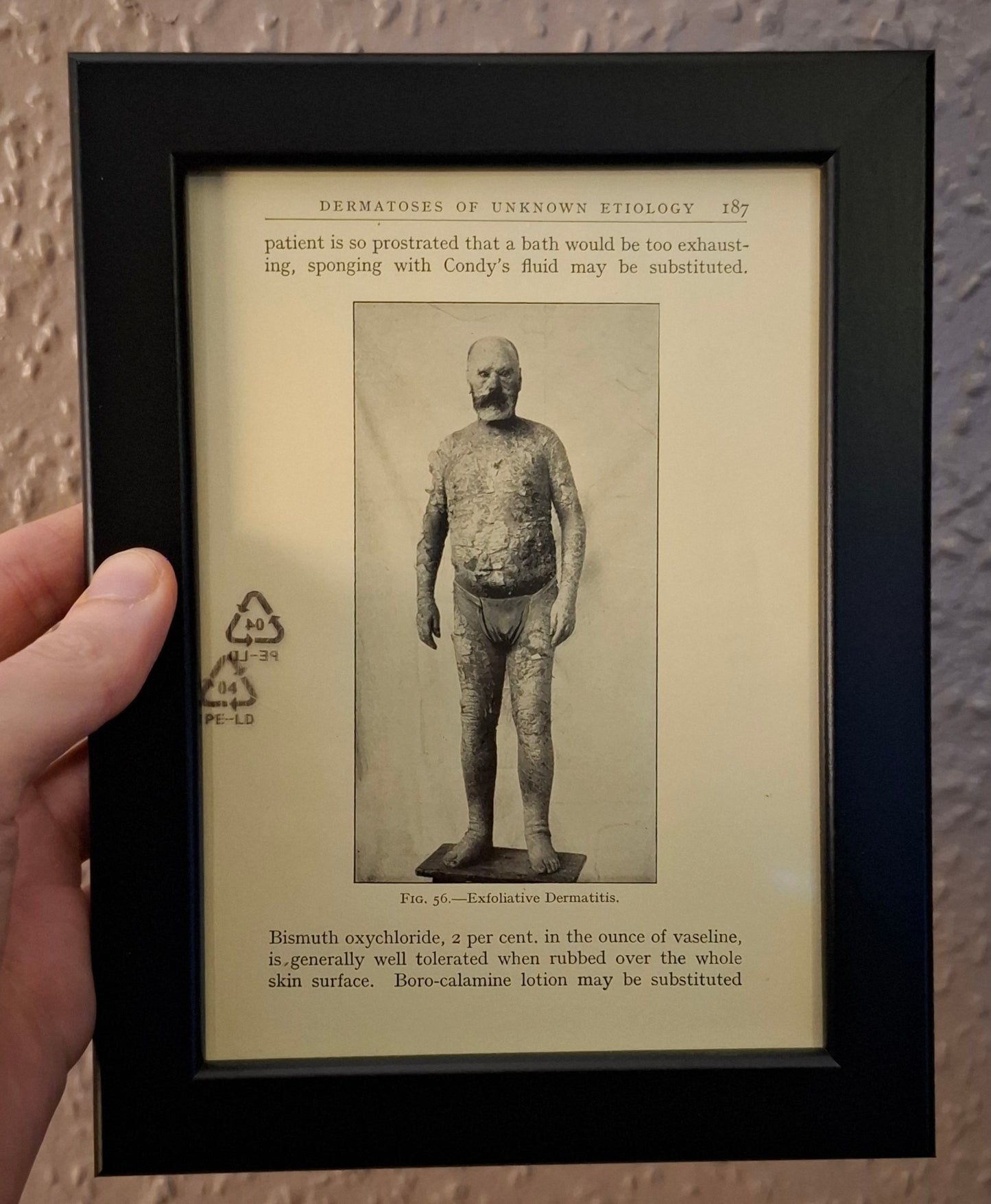 Framed Pages from an antique book on Skin Diseases