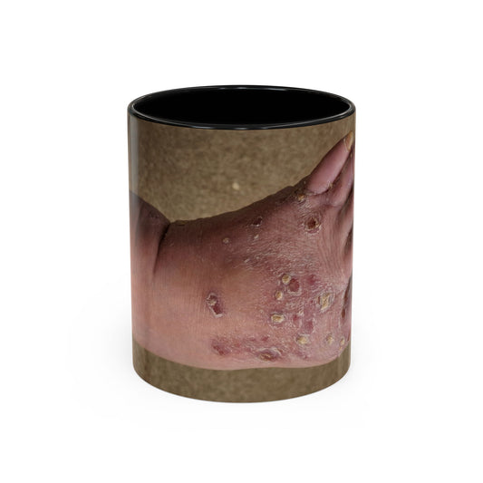 My Dad's Toes On A Mug