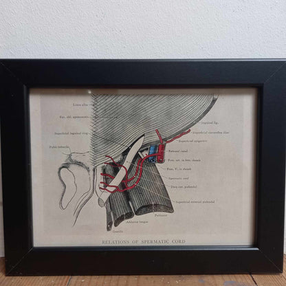 Antique Coloured Anatomical Diagrams (Framed)