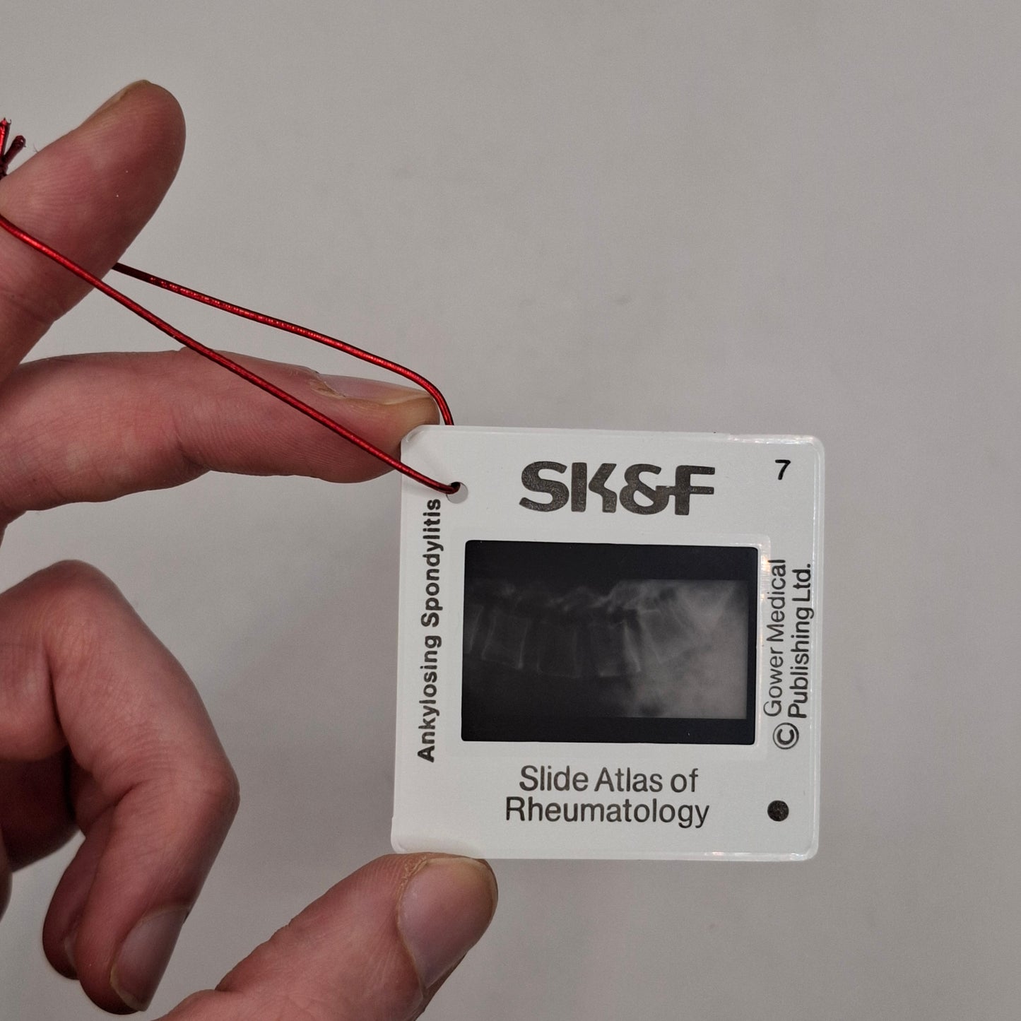 X-Ray Medical Slide