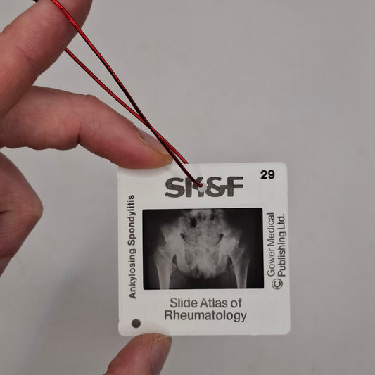 X-Ray Medical Slide
