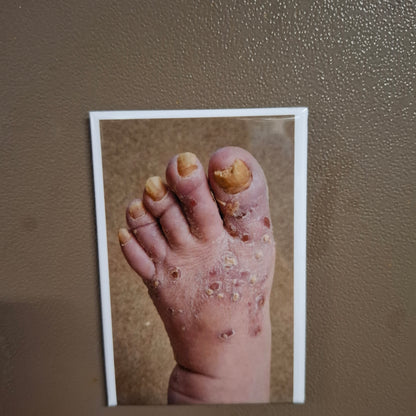My Dad's Toes 2025 Update - Fridge Magnet