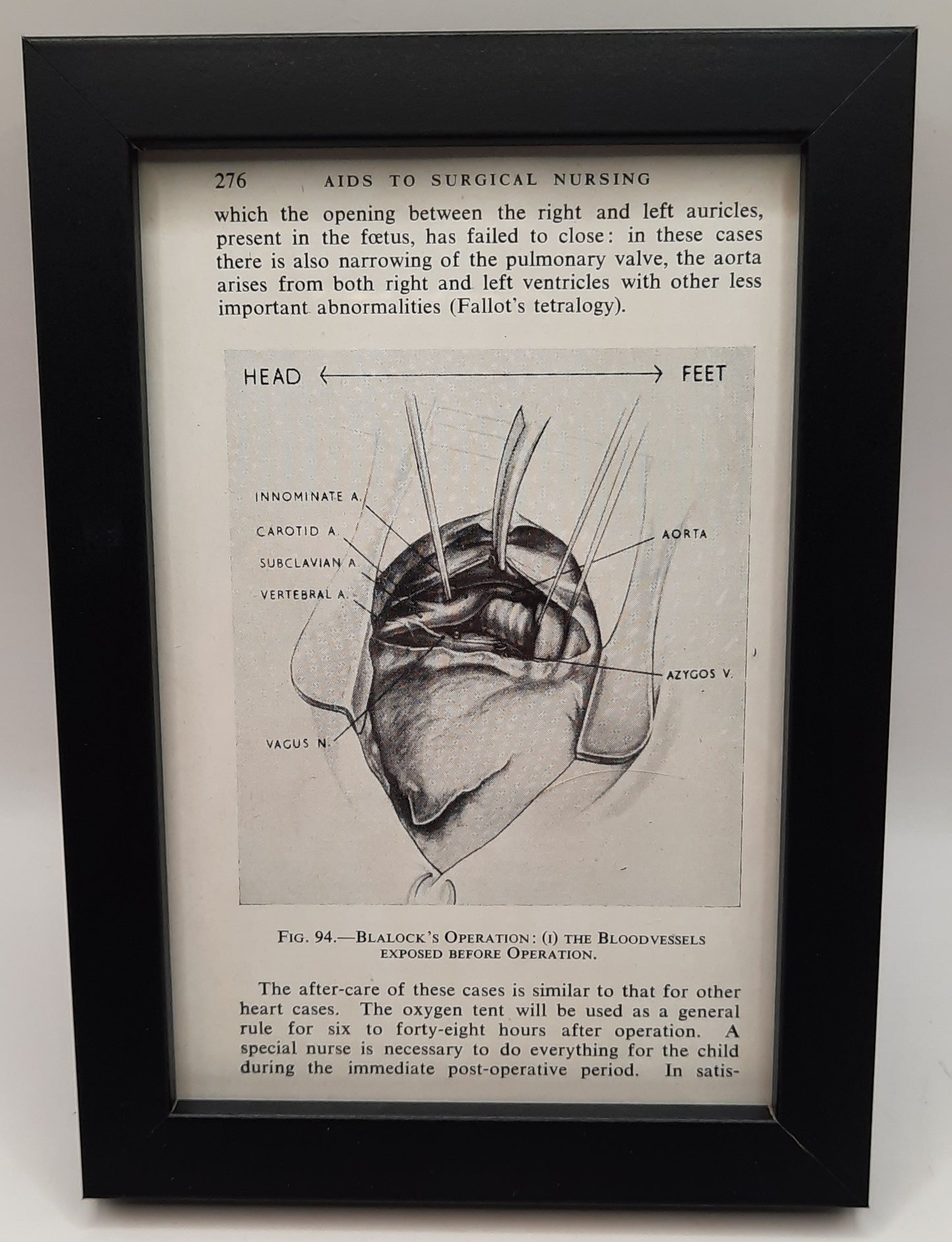 Surgical Nursing