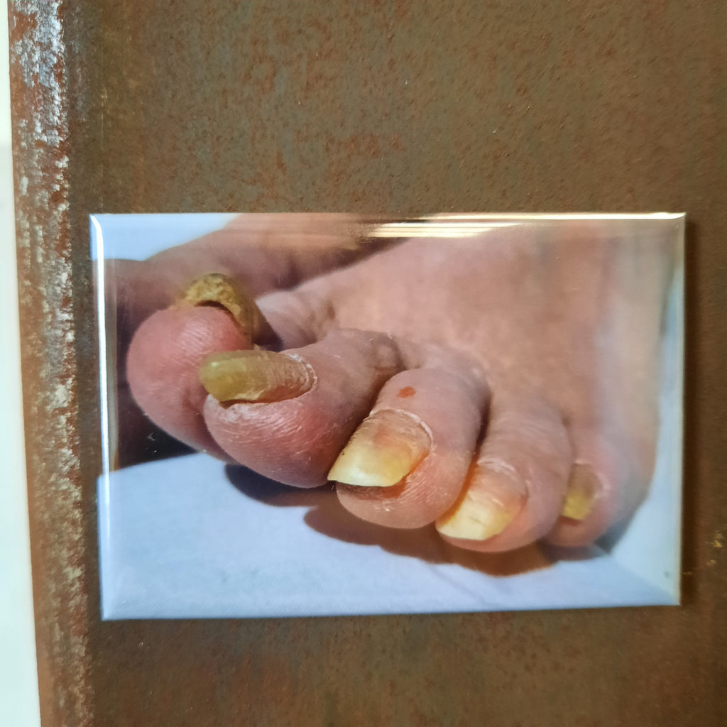 My Dad's Toes - Fridge Magnet