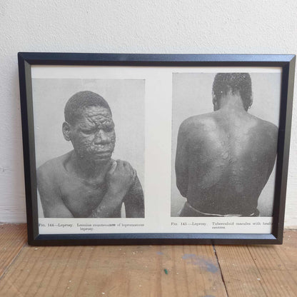 Framed Pages from an antique book on Skin Diseases