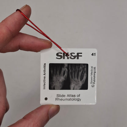 X-Ray Medical Slide