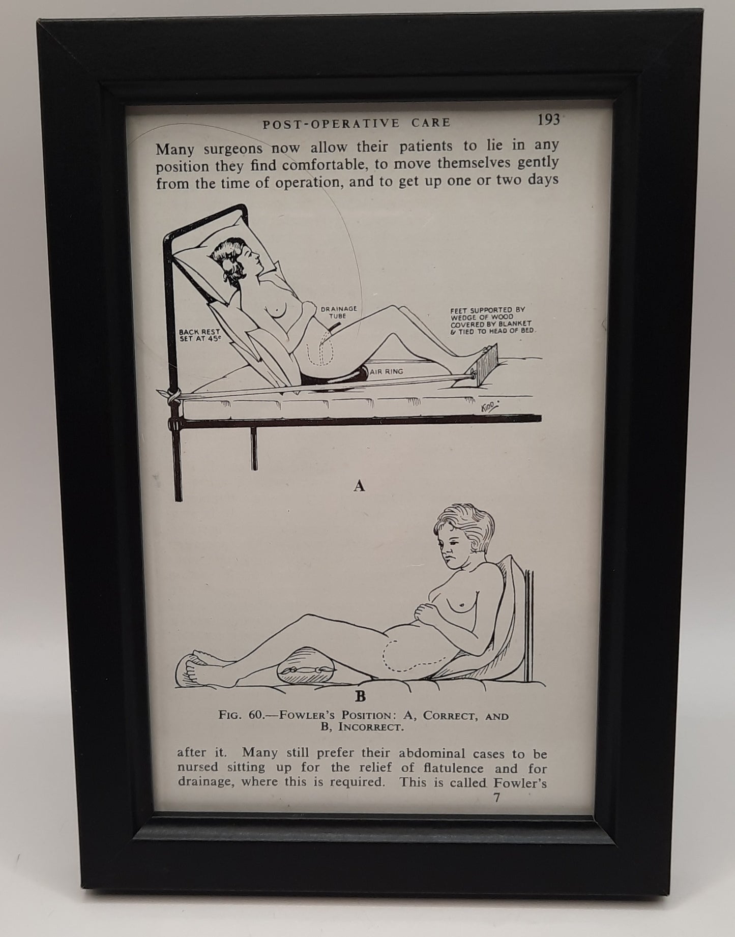 Framed Surgical Nursing