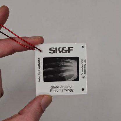 X-Ray Medical Slide