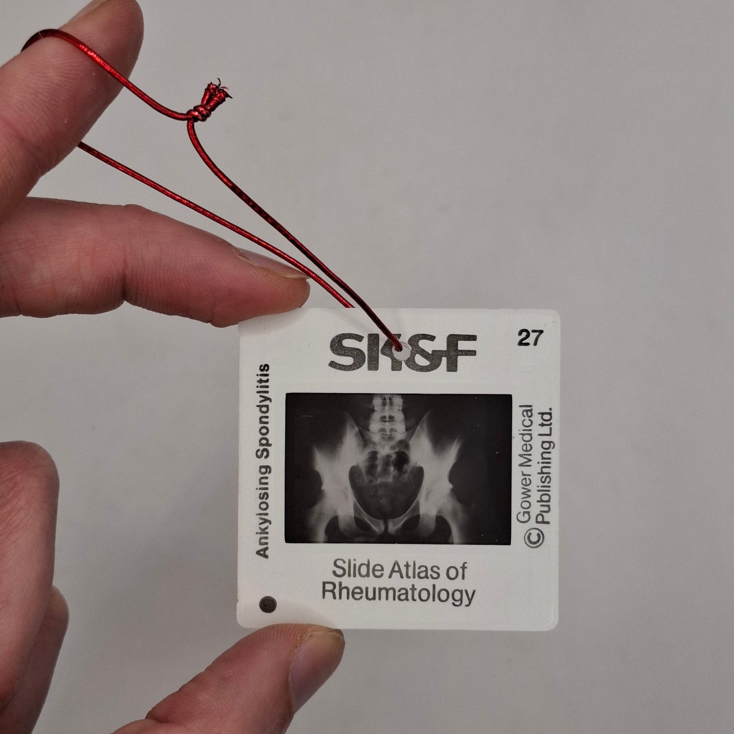 X-Ray Medical Slide