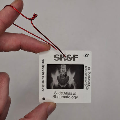 X-Ray Medical Slide