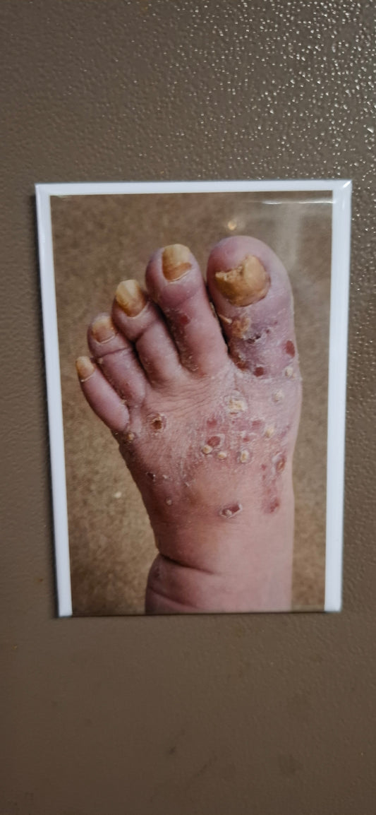 My Dad's Toes 2025 Update - Fridge Magnet