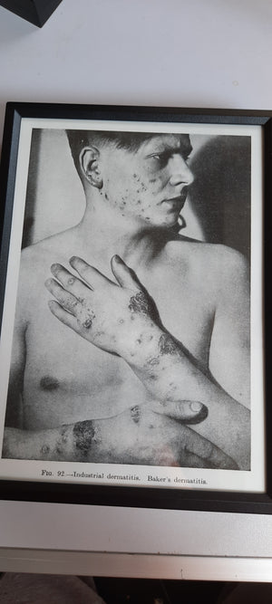 Framed Pages from an antique book on Skin Diseases