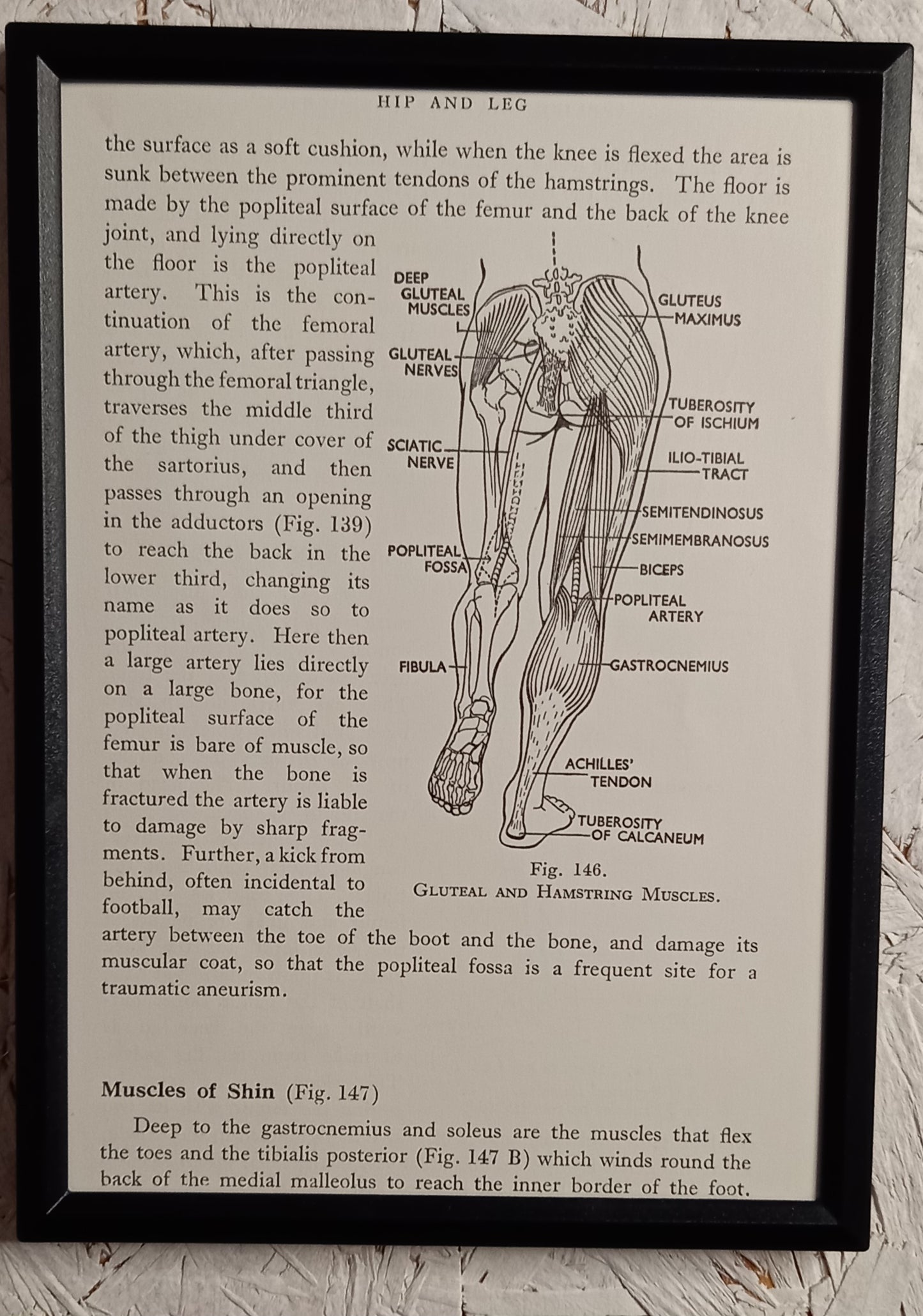 Applied Anatomy For Nurses - Framed Pages