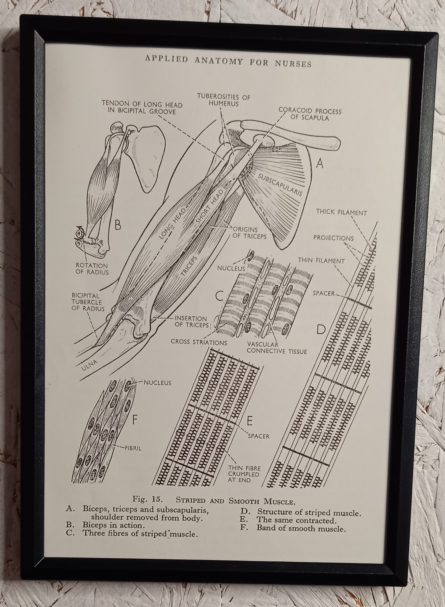 Applied Anatomy For Nurses - Framed Pages