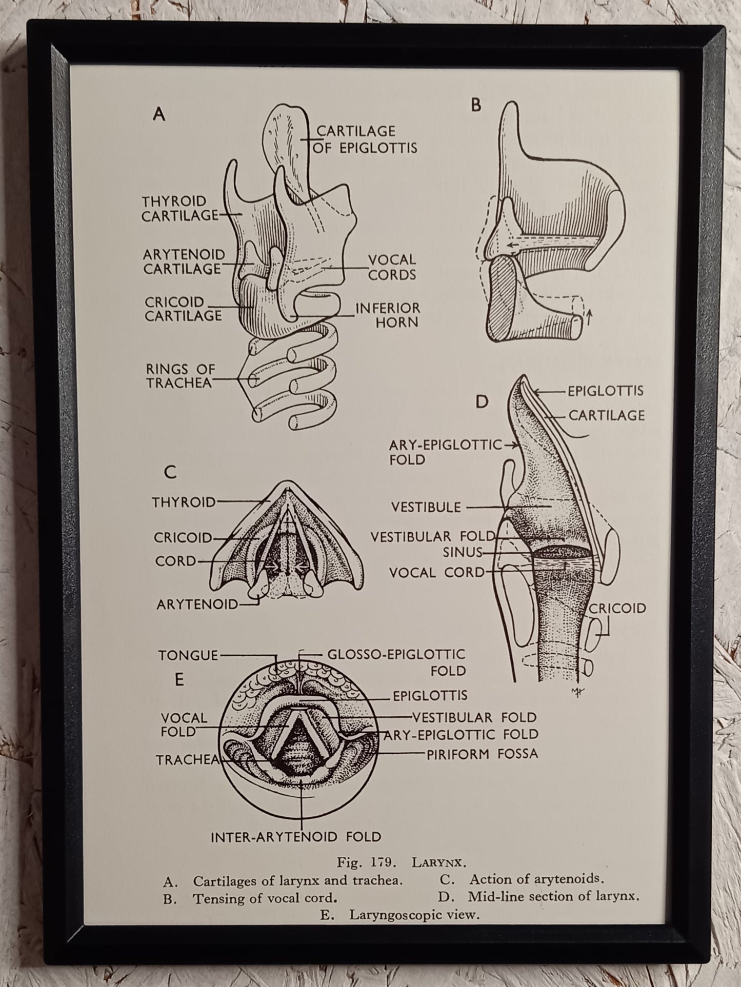 Applied Anatomy For Nurses - Framed Pages