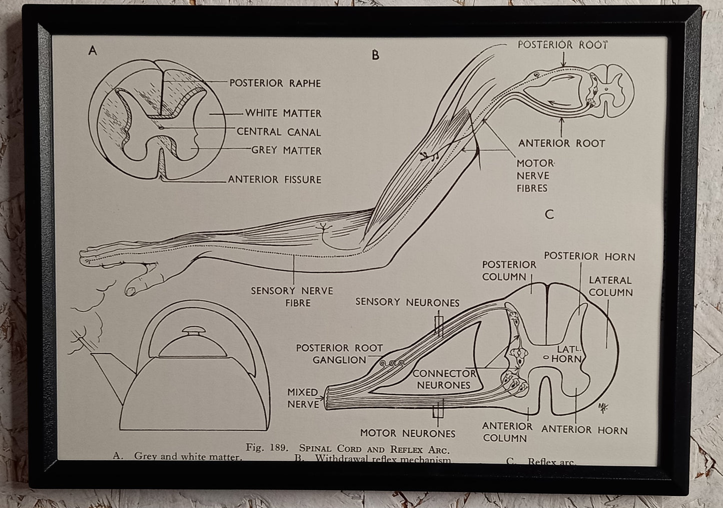 Applied Anatomy For Nurses - Framed Pages