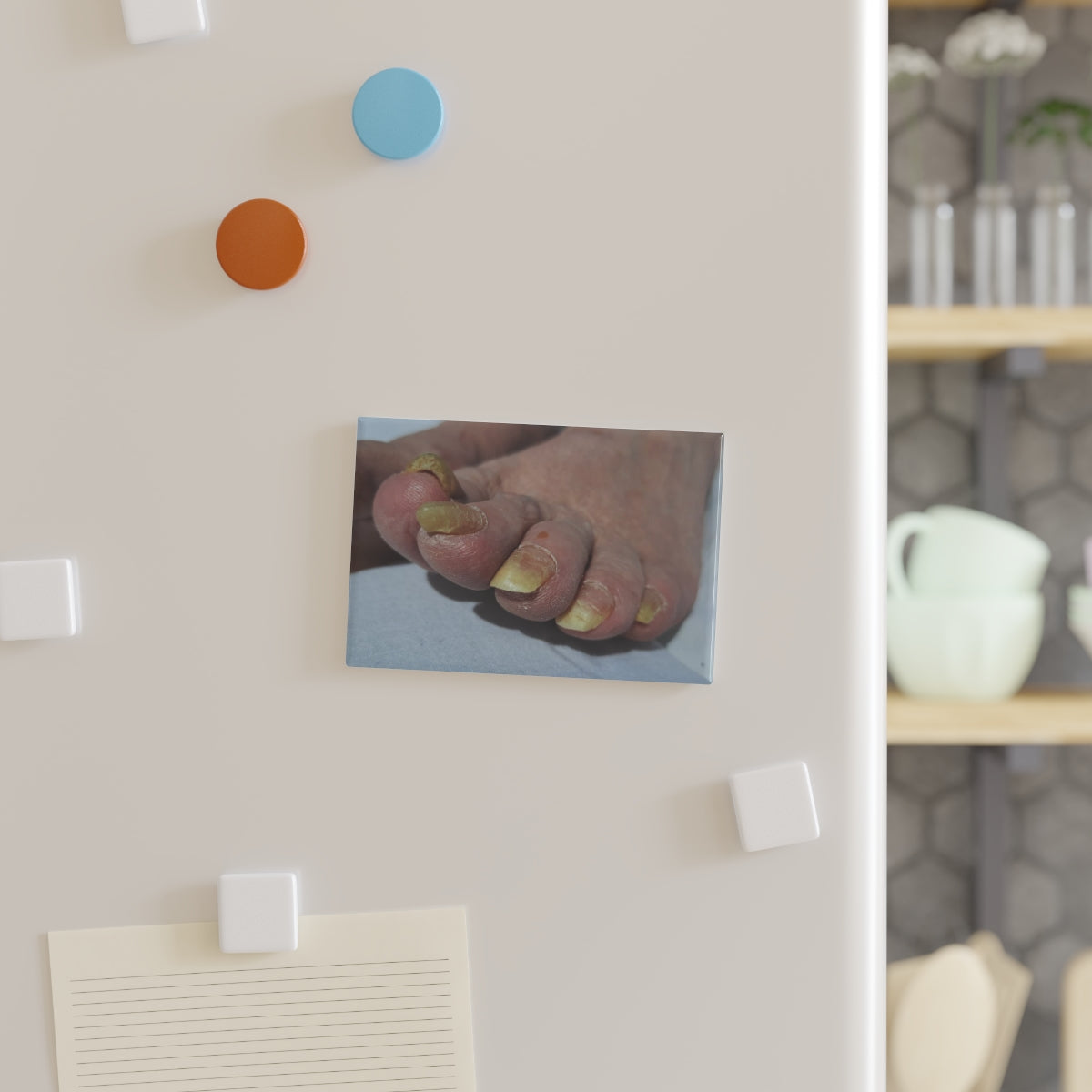 My Dads Toes - Fridge Magnet